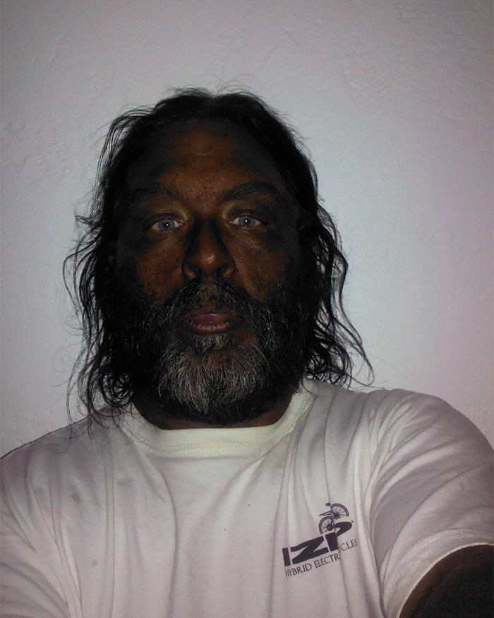 “Breaking New Ground”: Man Reveals Results After Injecting Himself With Unregulated Tanning Peptide Melanotan 2