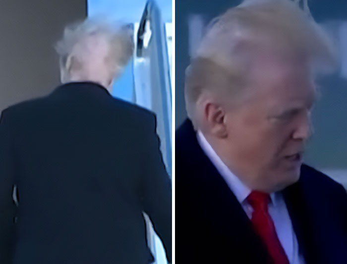 White House Accused Of Concealing Trump’s Medical History After Truth About Hair-Loss Treatment Discovered