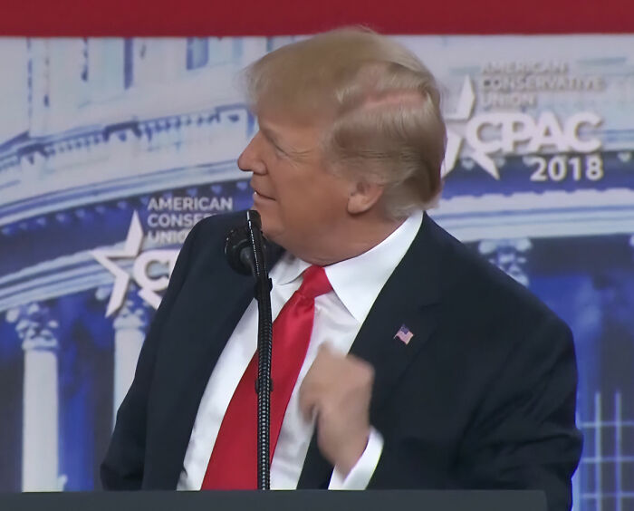 White House Accused Of Concealing Trump’s Medical History After Truth About Hair-Loss Treatment Discovered