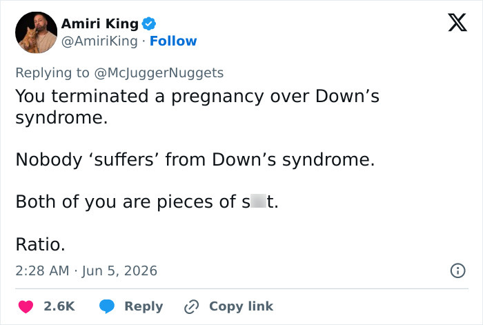 YouTuber’s Response To Outrage Backfires After He And Wife Terminated Pregnancy Because Baby Had Down Syndrome