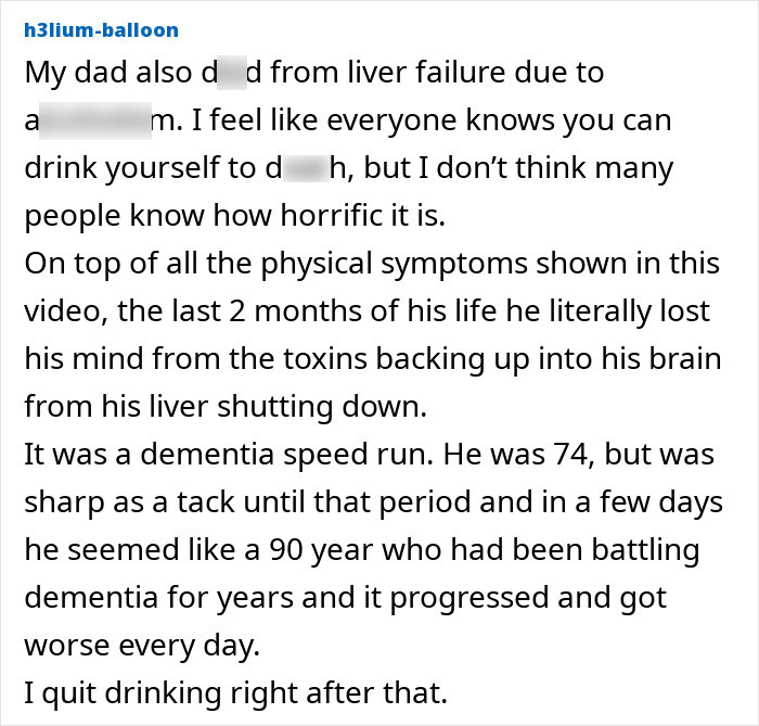 “Your Sign To Stop Now”: Woman’s Story Stuns As She Shares Experience With Liver Failure Due To Drinking