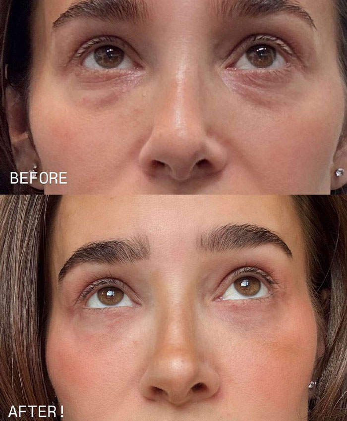 “Skeletonized Look”: Plastic Surgeons Say These Once-Trendy Procedures Are Now Their Patients&rsquo; Biggest Regrets