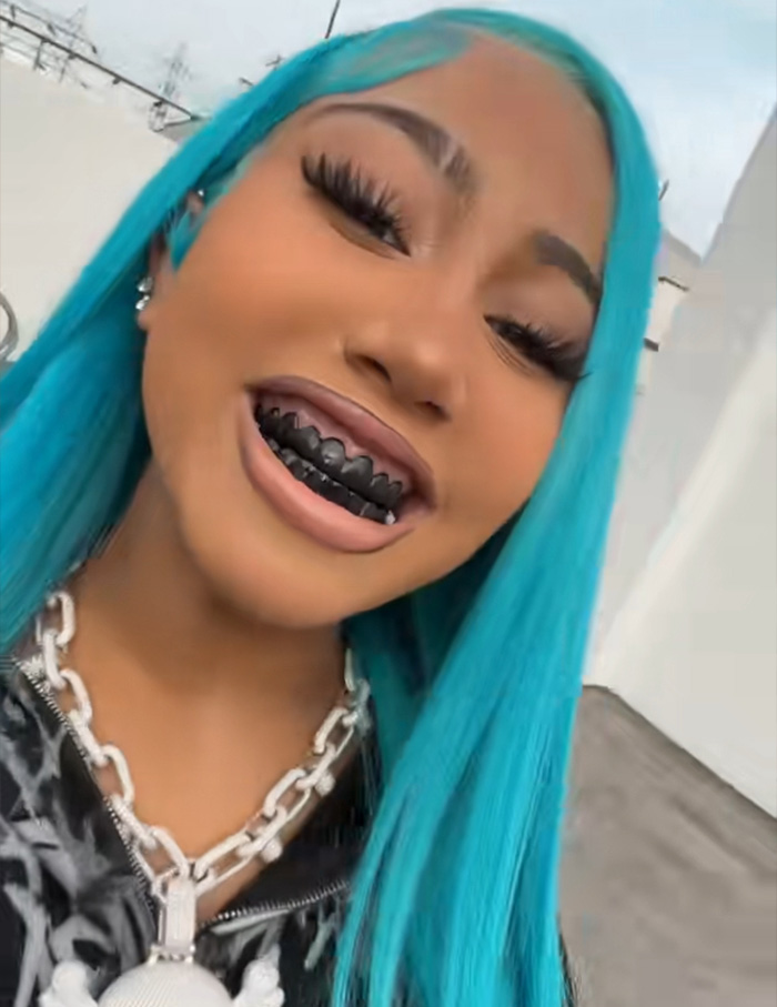 After North West Debuts ‘Blackened Teeth,’ Experts Reveal What Many People Don’t Know About Black Grills