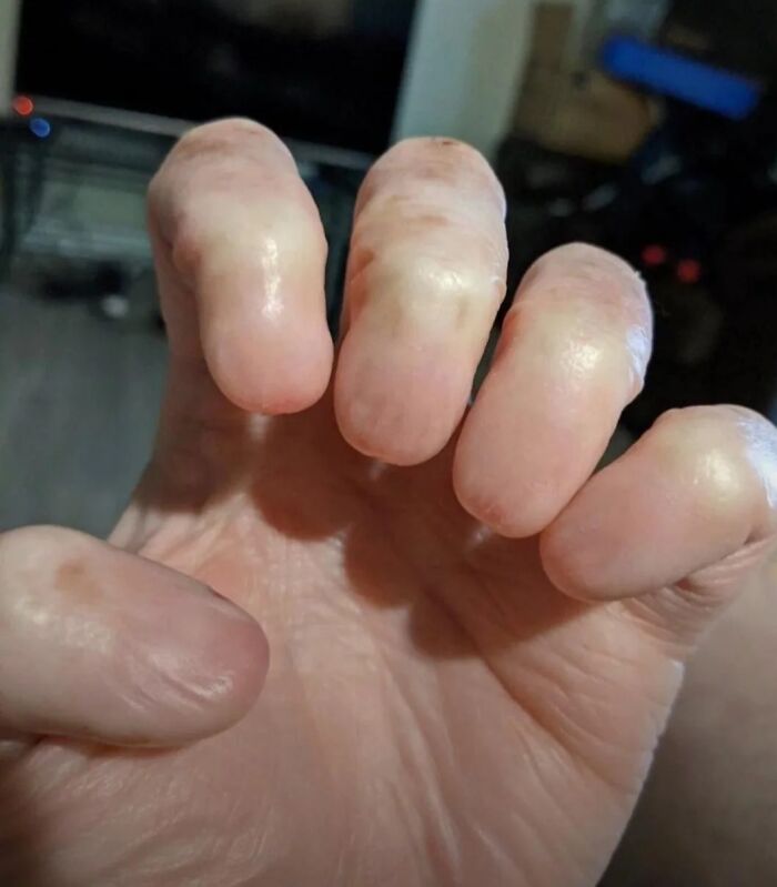 &ldquo;Wife Hasn&rsquo;t Eaten Eggs Since&rdquo;: 83 Oddly Terrifying Images That Are Not For The Weak (New Pics)
