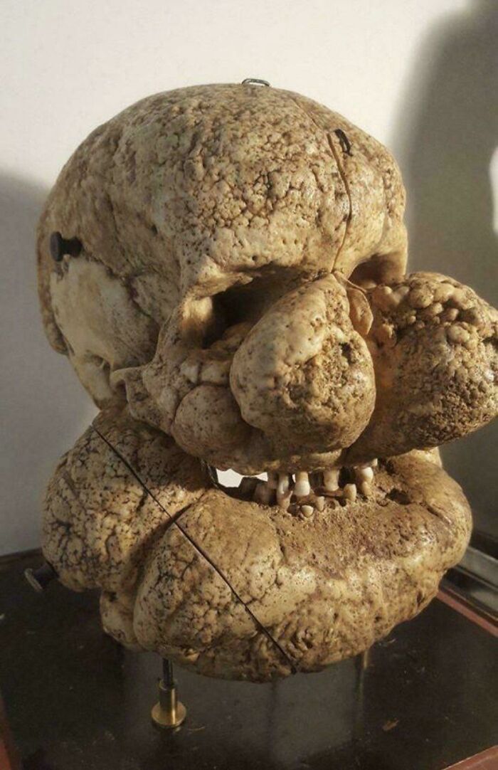 &ldquo;Wife Hasn&rsquo;t Eaten Eggs Since&rdquo;: 83 Oddly Terrifying Images That Are Not For The Weak (New Pics)