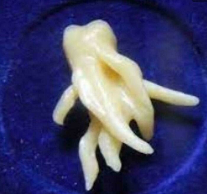 &ldquo;Wife Hasn&rsquo;t Eaten Eggs Since&rdquo;: 83 Oddly Terrifying Images That Are Not For The Weak (New Pics)