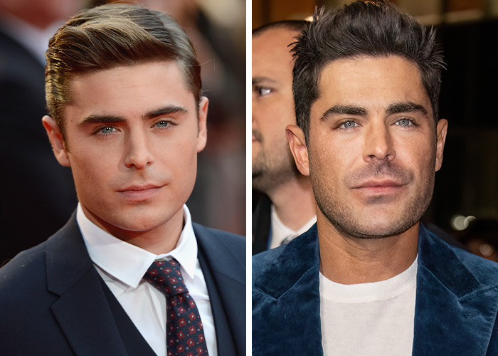 9 Famous Men Hit With Plastic Surgery Scrutiny After Dramatic Appearance Changes 9 Famous Men Hit With Plastic Surgery Scrutiny After Dramatic Appearance Changes