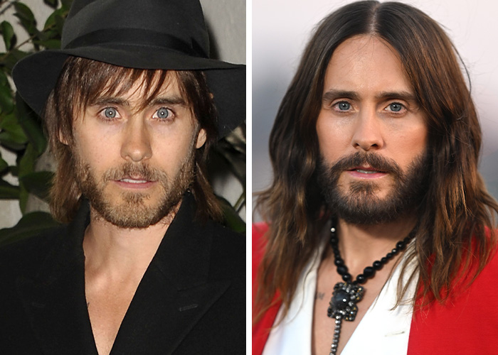 9 Famous Men Hit With Plastic Surgery Scrutiny After Dramatic Appearance Changes 9 Famous Men Hit With Plastic Surgery Scrutiny After Dramatic Appearance Changes
