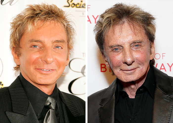 9 Famous Men Hit With Plastic Surgery Scrutiny After Dramatic Appearance Changes 9 Famous Men Hit With Plastic Surgery Scrutiny After Dramatic Appearance Changes