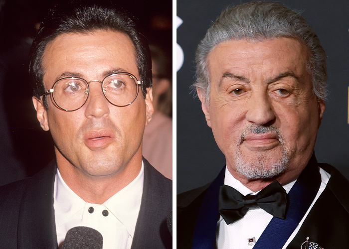 9 Famous Men Hit With Plastic Surgery Scrutiny After Dramatic Appearance Changes 9 Famous Men Hit With Plastic Surgery Scrutiny After Dramatic Appearance Changes