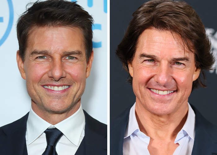 9 Famous Men Hit With Plastic Surgery Scrutiny After Dramatic Appearance Changes 9 Famous Men Hit With Plastic Surgery Scrutiny After Dramatic Appearance Changes