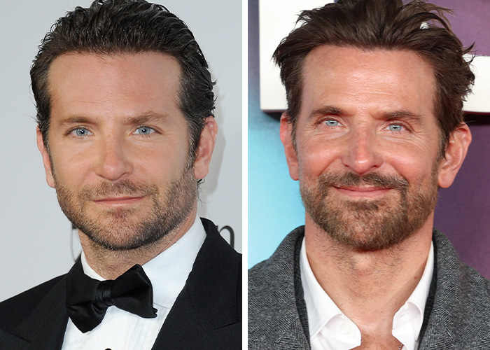 9 Famous Men Hit With Plastic Surgery Scrutiny After Dramatic Appearance Changes 9 Famous Men Hit With Plastic Surgery Scrutiny After Dramatic Appearance Changes