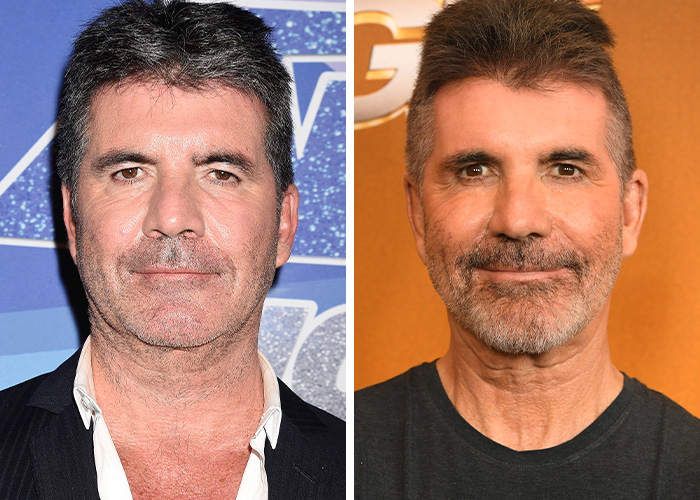 9 Famous Men Hit With Plastic Surgery Scrutiny After Dramatic Appearance Changes 9 Famous Men Hit With Plastic Surgery Scrutiny After Dramatic Appearance Changes