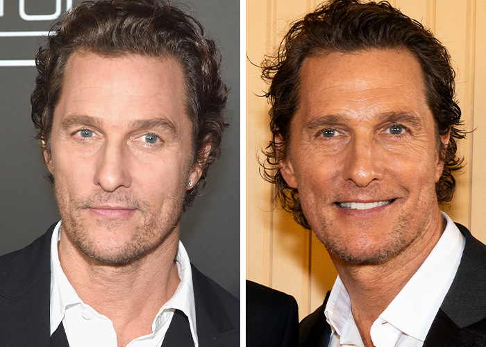 9 Famous Men Hit With Plastic Surgery Scrutiny After Dramatic Appearance Changes 9 Famous Men Hit With Plastic Surgery Scrutiny After Dramatic Appearance Changes