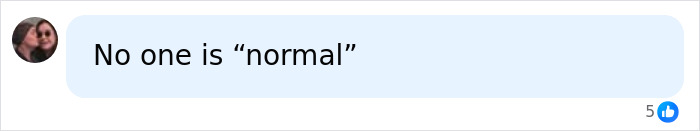 After Backlash On Down’s Syndrome Pregnancy Termination, YouTuber Jesse Ridgeway States He’s “Normal” After Backlash On Down’s Syndrome Pregnancy Termination, YouTuber Jesse Ridgeway States He’s “Normal”
