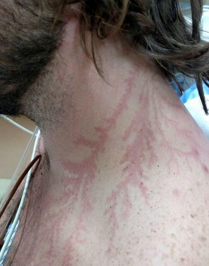 61 Interesting Photos Of Human Body Quirks That Are Both Fascinating And Shocking (New Pics) 61 Interesting Photos Of Human Body Quirks That Are Both Fascinating And Shocking (New Pics)