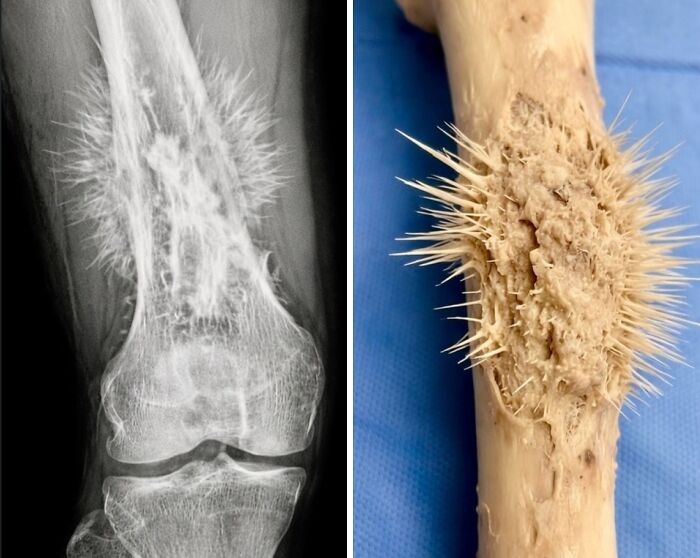 61 Interesting Photos Of Human Body Quirks That Are Both Fascinating And Shocking (New Pics) 61 Interesting Photos Of Human Body Quirks That Are Both Fascinating And Shocking (New Pics)