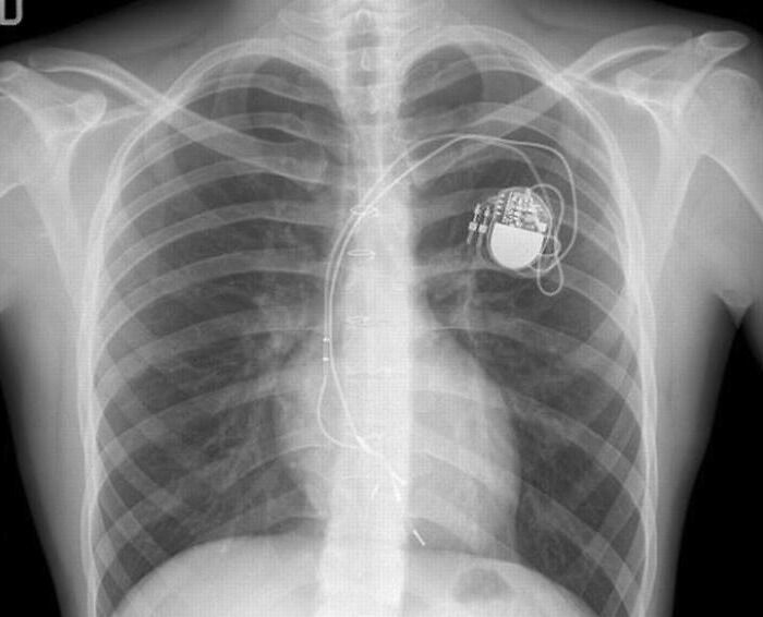 61 Interesting Photos Of Human Body Quirks That Are Both Fascinating And Shocking (New Pics) 61 Interesting Photos Of Human Body Quirks That Are Both Fascinating And Shocking (New Pics)