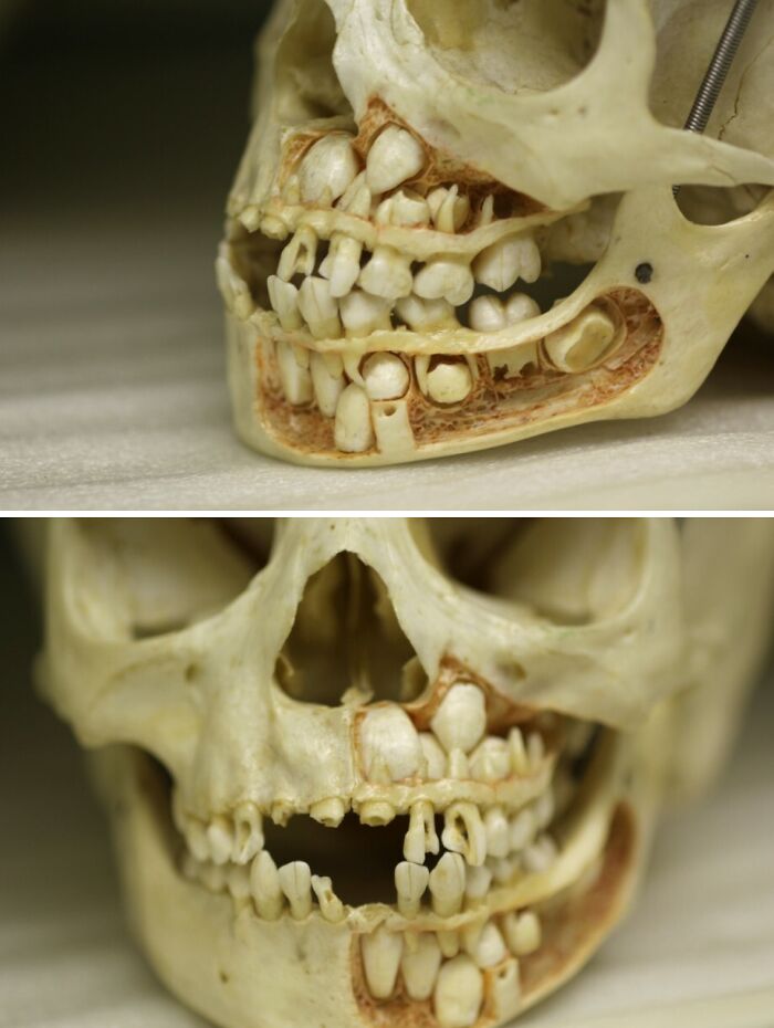 61 Interesting Photos Of Human Body Quirks That Are Both Fascinating And Shocking (New Pics) 61 Interesting Photos Of Human Body Quirks That Are Both Fascinating And Shocking (New Pics)