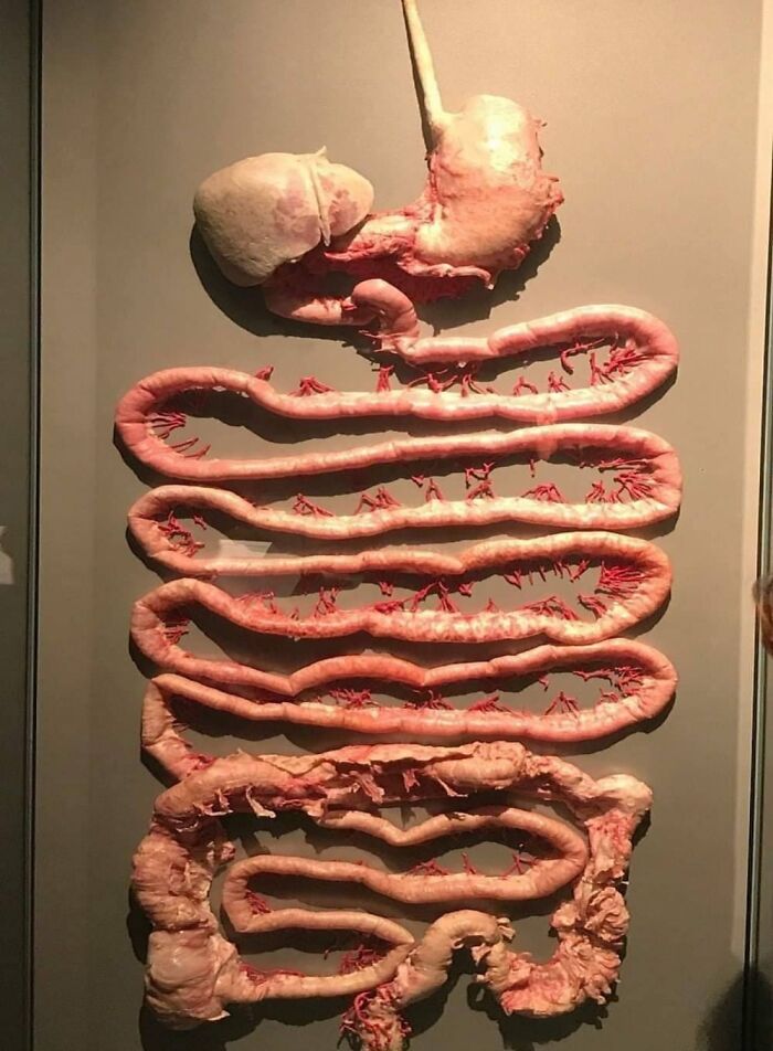 61 Interesting Photos Of Human Body Quirks That Are Both Fascinating And Shocking (New Pics) 61 Interesting Photos Of Human Body Quirks That Are Both Fascinating And Shocking (New Pics)