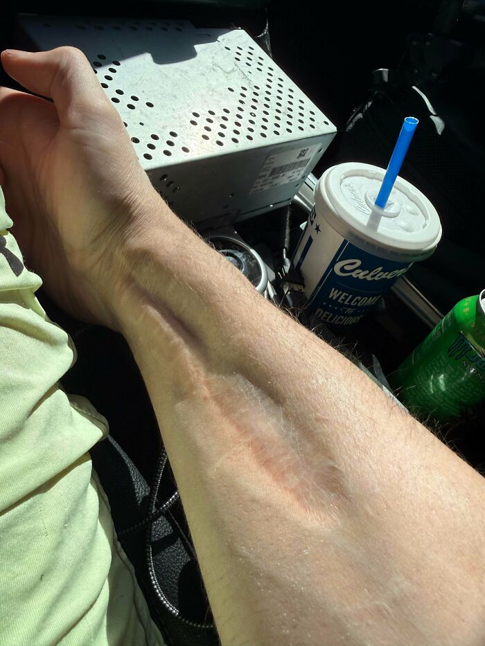 61 Interesting Photos Of Human Body Quirks That Are Both Fascinating And Shocking (New Pics) 61 Interesting Photos Of Human Body Quirks That Are Both Fascinating And Shocking (New Pics)