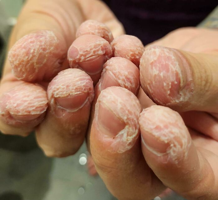 61 Interesting Photos Of Human Body Quirks That Are Both Fascinating And Shocking (New Pics) 61 Interesting Photos Of Human Body Quirks That Are Both Fascinating And Shocking (New Pics)
