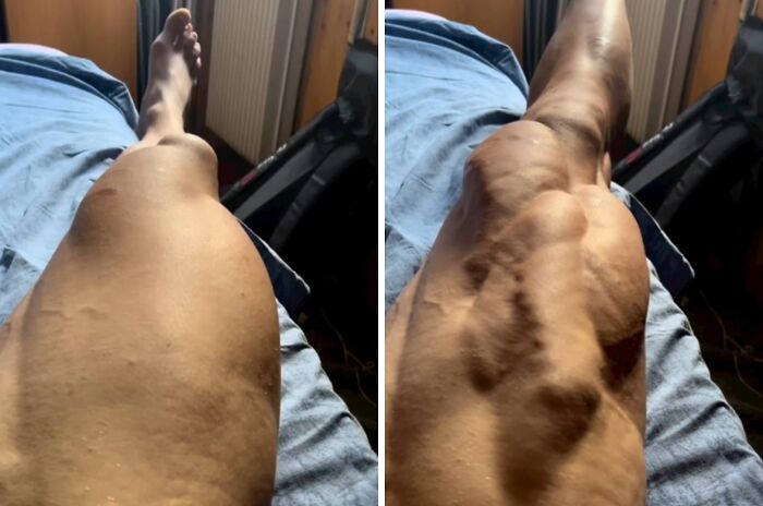 61 Interesting Photos Of Human Body Quirks That Are Both Fascinating And Shocking (New Pics) 61 Interesting Photos Of Human Body Quirks That Are Both Fascinating And Shocking (New Pics)