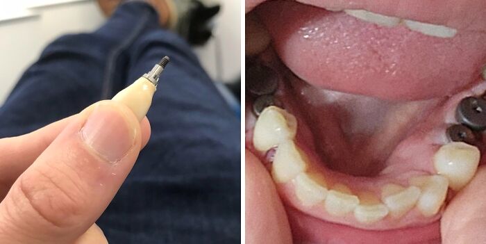 61 Interesting Photos Of Human Body Quirks That Are Both Fascinating And Shocking (New Pics) 61 Interesting Photos Of Human Body Quirks That Are Both Fascinating And Shocking (New Pics)