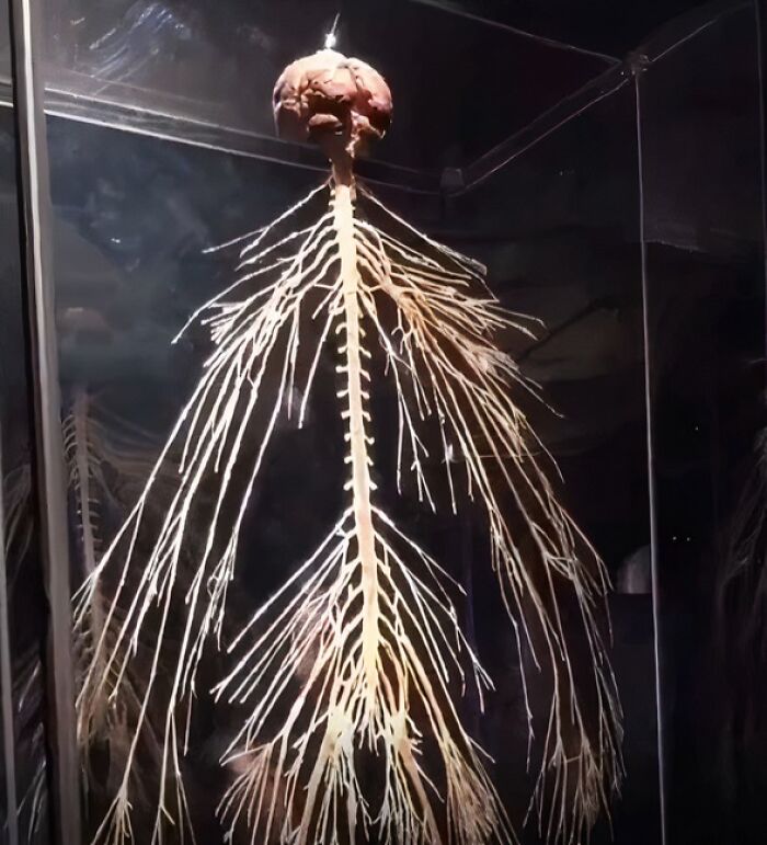 61 Interesting Photos Of Human Body Quirks That Are Both Fascinating And Shocking (New Pics) 61 Interesting Photos Of Human Body Quirks That Are Both Fascinating And Shocking (New Pics)