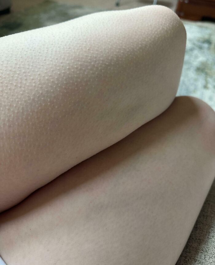 61 Interesting Photos Of Human Body Quirks That Are Both Fascinating And Shocking (New Pics) 61 Interesting Photos Of Human Body Quirks That Are Both Fascinating And Shocking (New Pics)