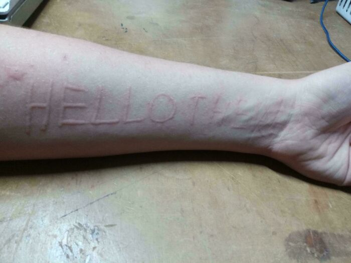 61 Interesting Photos Of Human Body Quirks That Are Both Fascinating And Shocking (New Pics) 61 Interesting Photos Of Human Body Quirks That Are Both Fascinating And Shocking (New Pics)