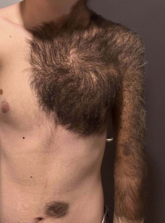 61 Interesting Photos Of Human Body Quirks That Are Both Fascinating And Shocking (New Pics) 61 Interesting Photos Of Human Body Quirks That Are Both Fascinating And Shocking (New Pics)