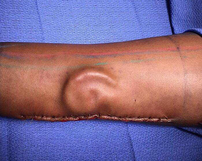 61 Interesting Photos Of Human Body Quirks That Are Both Fascinating And Shocking (New Pics) 61 Interesting Photos Of Human Body Quirks That Are Both Fascinating And Shocking (New Pics)