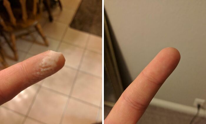 61 Interesting Photos Of Human Body Quirks That Are Both Fascinating And Shocking (New Pics) 61 Interesting Photos Of Human Body Quirks That Are Both Fascinating And Shocking (New Pics)