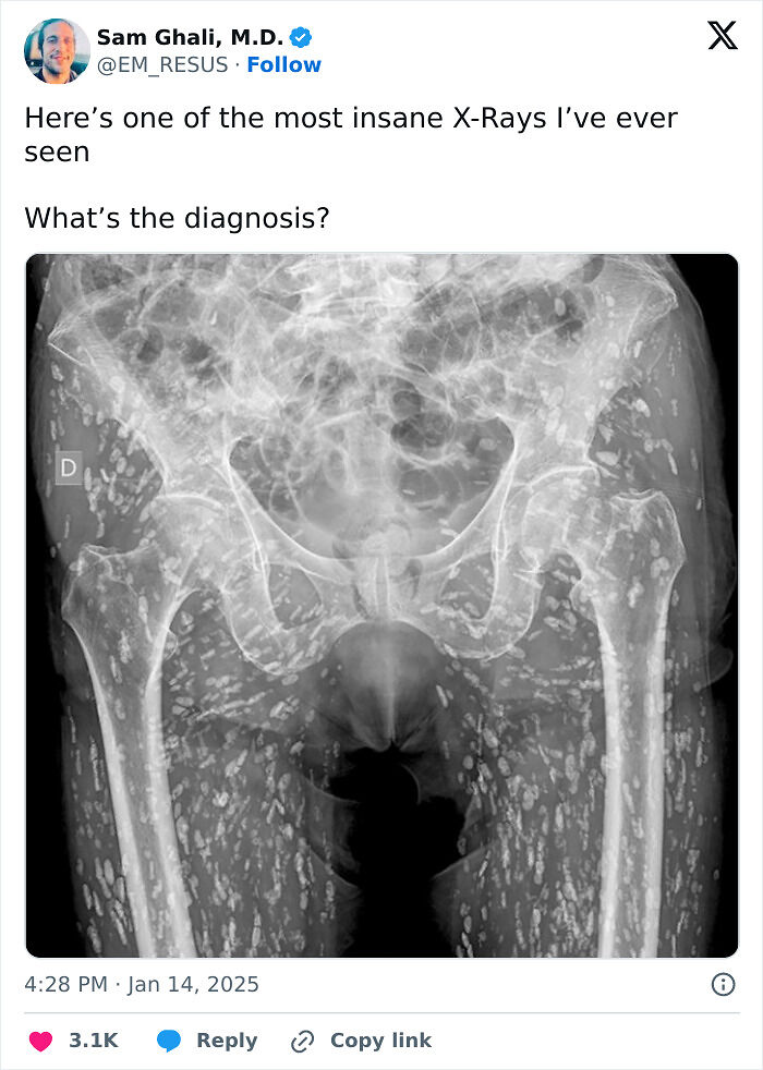 61 Interesting Photos Of Human Body Quirks That Are Both Fascinating And Shocking (New Pics) 61 Interesting Photos Of Human Body Quirks That Are Both Fascinating And Shocking (New Pics)