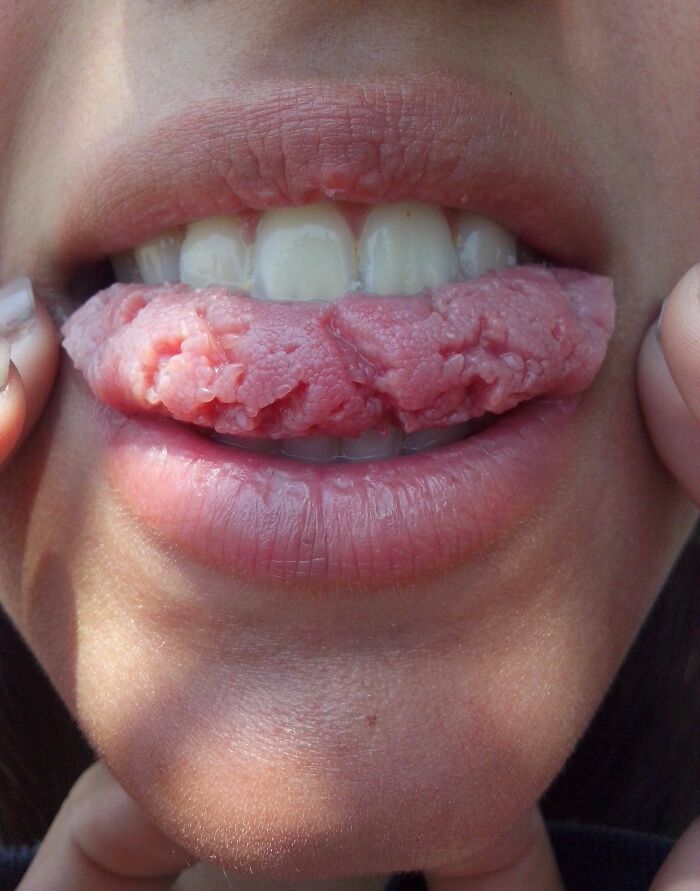 61 Interesting Photos Of Human Body Quirks That Are Both Fascinating And Shocking (New Pics) 61 Interesting Photos Of Human Body Quirks That Are Both Fascinating And Shocking (New Pics)