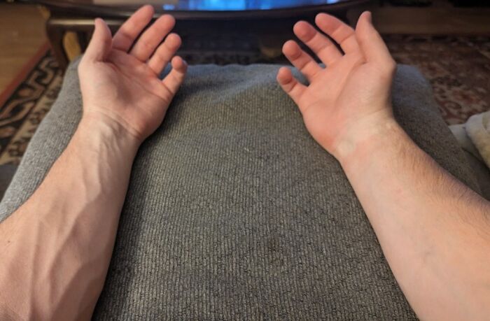 61 Interesting Photos Of Human Body Quirks That Are Both Fascinating And Shocking (New Pics) 61 Interesting Photos Of Human Body Quirks That Are Both Fascinating And Shocking (New Pics)