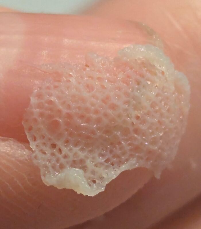 61 Interesting Photos Of Human Body Quirks That Are Both Fascinating And Shocking (New Pics) 61 Interesting Photos Of Human Body Quirks That Are Both Fascinating And Shocking (New Pics)