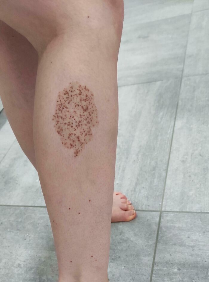 61 Interesting Photos Of Human Body Quirks That Are Both Fascinating And Shocking (New Pics) 61 Interesting Photos Of Human Body Quirks That Are Both Fascinating And Shocking (New Pics)