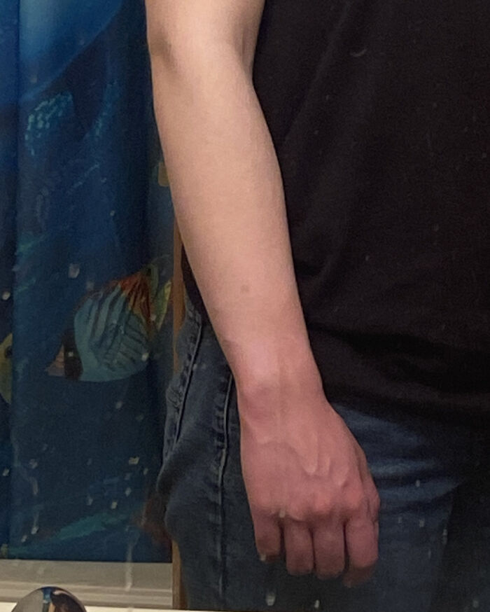 61 Interesting Photos Of Human Body Quirks That Are Both Fascinating And Shocking (New Pics) 61 Interesting Photos Of Human Body Quirks That Are Both Fascinating And Shocking (New Pics)