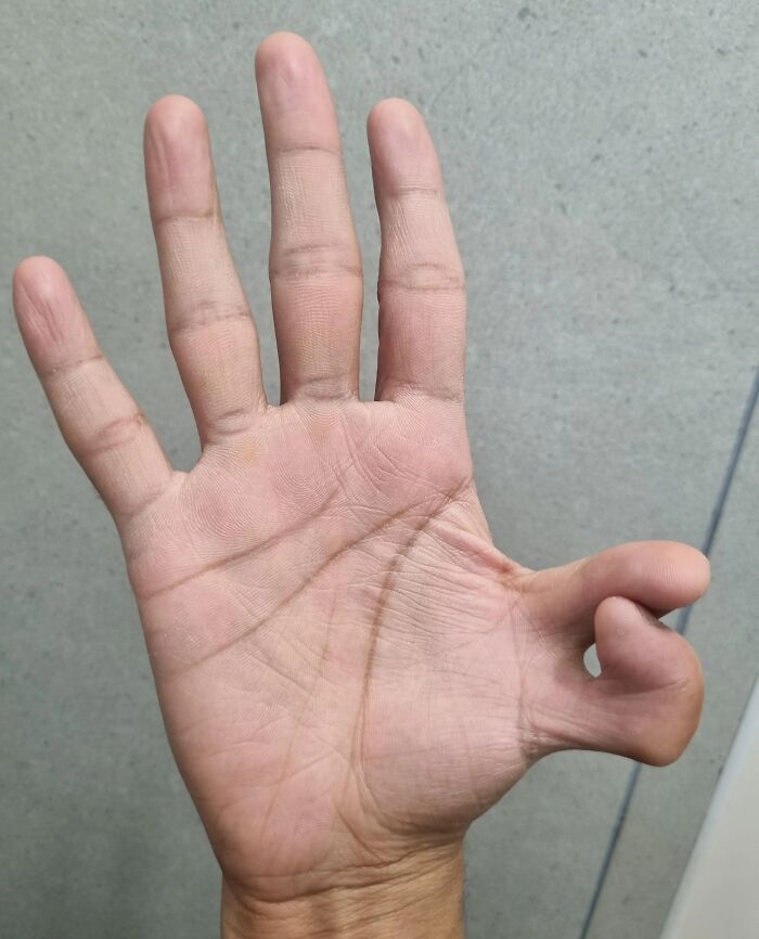 61 Interesting Photos Of Human Body Quirks That Are Both Fascinating And Shocking (New Pics) 61 Interesting Photos Of Human Body Quirks That Are Both Fascinating And Shocking (New Pics)