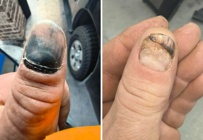 61 Interesting Photos Of Human Body Quirks That Are Both Fascinating And Shocking (New Pics) 61 Interesting Photos Of Human Body Quirks That Are Both Fascinating And Shocking (New Pics)