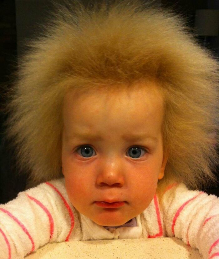 61 Interesting Photos Of Human Body Quirks That Are Both Fascinating And Shocking (New Pics) 61 Interesting Photos Of Human Body Quirks That Are Both Fascinating And Shocking (New Pics)