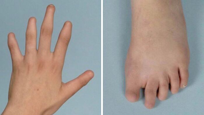 61 Interesting Photos Of Human Body Quirks That Are Both Fascinating And Shocking (New Pics) 61 Interesting Photos Of Human Body Quirks That Are Both Fascinating And Shocking (New Pics)