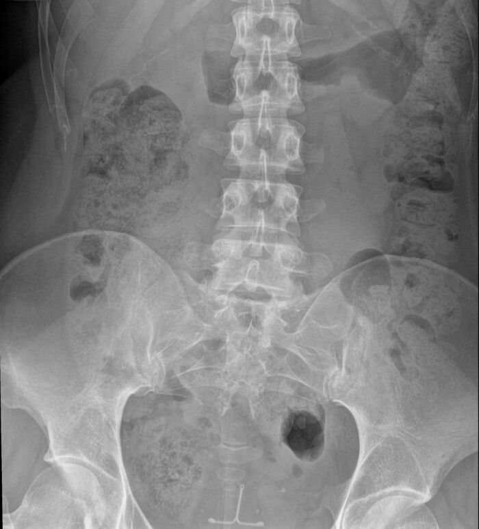 61 Interesting Photos Of Human Body Quirks That Are Both Fascinating And Shocking (New Pics) 61 Interesting Photos Of Human Body Quirks That Are Both Fascinating And Shocking (New Pics)