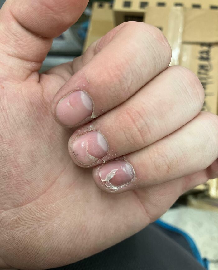 61 Interesting Photos Of Human Body Quirks That Are Both Fascinating And Shocking (New Pics) 61 Interesting Photos Of Human Body Quirks That Are Both Fascinating And Shocking (New Pics)