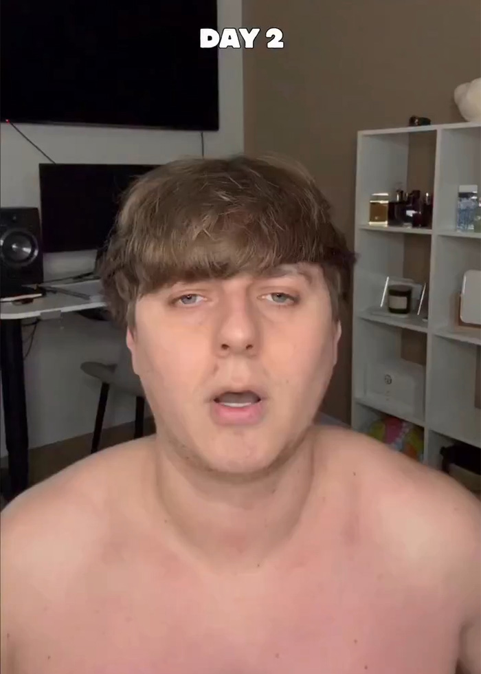 Man Reveals Dramatic 80-Day Transformation After Daily Jaw Exercises Man Reveals Dramatic 80-Day Transformation After Daily Jaw Exercises