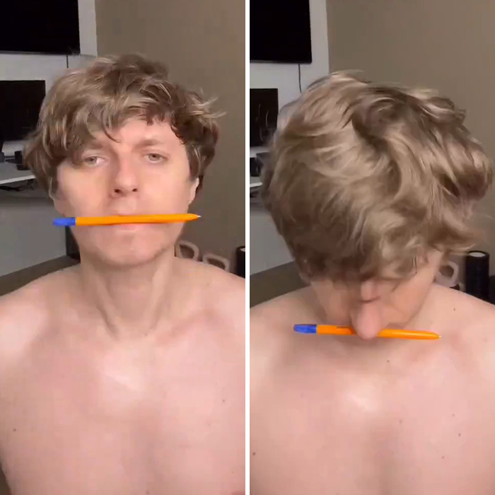 Man Reveals Dramatic 80-Day Transformation After Daily Jaw Exercises Man Reveals Dramatic 80-Day Transformation After Daily Jaw Exercises