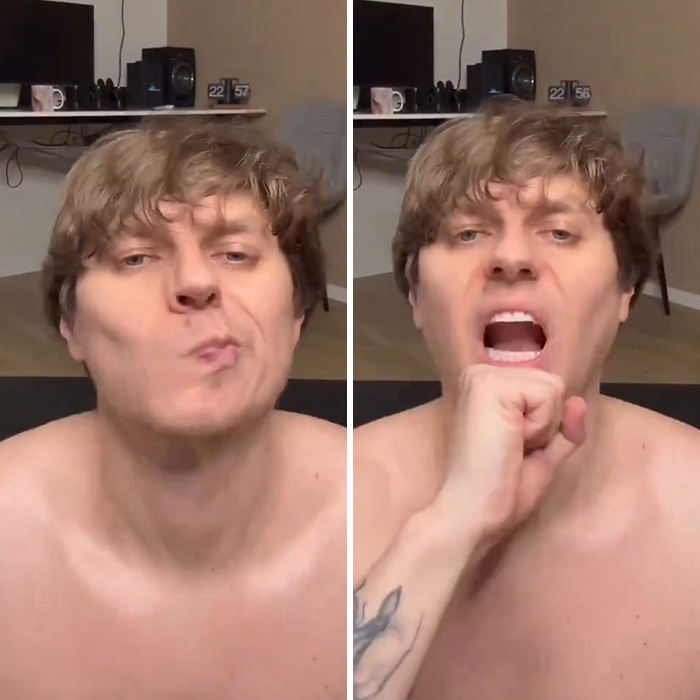 Man Reveals Dramatic 80-Day Transformation After Daily Jaw Exercises Man Reveals Dramatic 80-Day Transformation After Daily Jaw Exercises