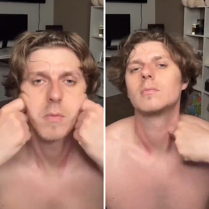 Man Reveals Dramatic 80-Day Transformation After Daily Jaw Exercises Man Reveals Dramatic 80-Day Transformation After Daily Jaw Exercises